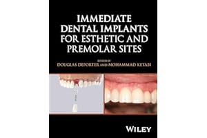 Immediate Dental Implants for Esthetic and Premolar Sites