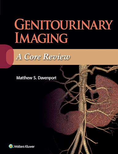 Download Genitourinary Imaging: A Core Review (English Edition) PDF