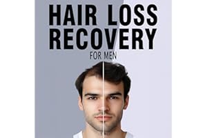 Hair Loss Recovery for Men: Fix Your Hair Naturally, Optimize Hair Growth, and Regain Your Confidence
