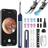 Ear Camera Wax Removal, Bebird Note 5 Ear Wax Removal Tool Camera Ear Tweezers with Camera, 10 Megapixels Ear Otoscope Camera