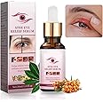 Stye Eyes Treatment,1.01 Fl oz/30 Ml Eye Stye Remover, Relieve Eyes Fatigue,Chalazion Remover, Stye Eye Relief Serum for Chalazion and Blepharitis