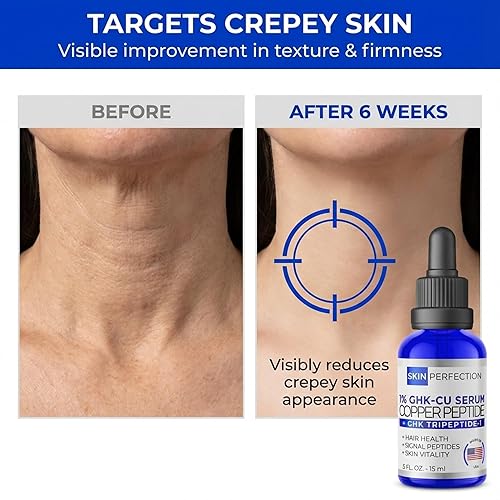 Skin Perfection Copper Peptide Serum GHK-CU 1% for Face & Hair Copper  Peptides for Skin,