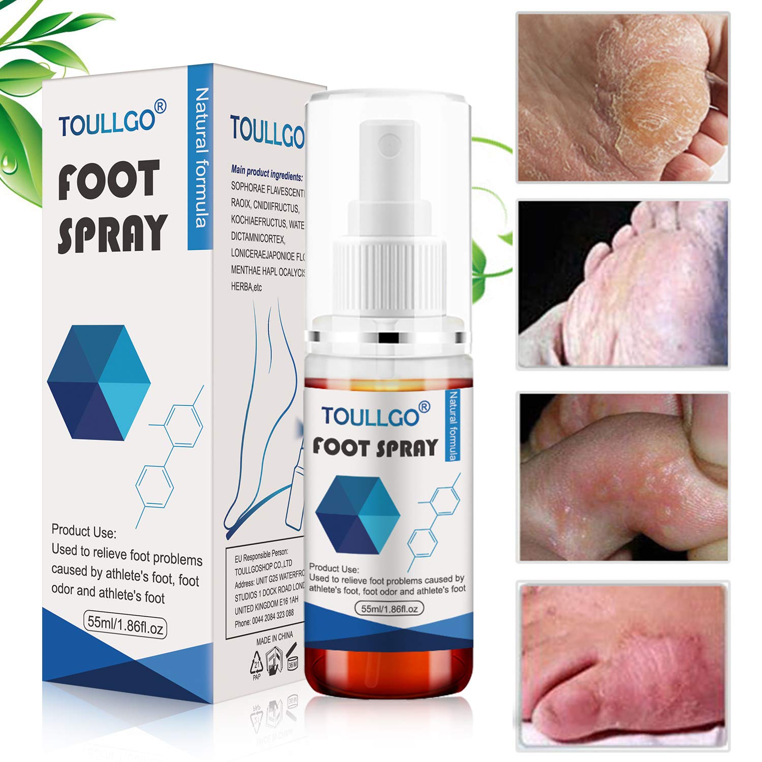 Foot Spray,Athletes Foot Spray,Natural formula Spray,Natural Shoe