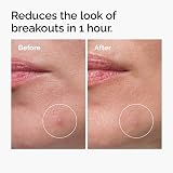 The Ordinary Sulfur 10% Powder-to-Cream Concentrate 5g - Blemish-Prone Skin view 4