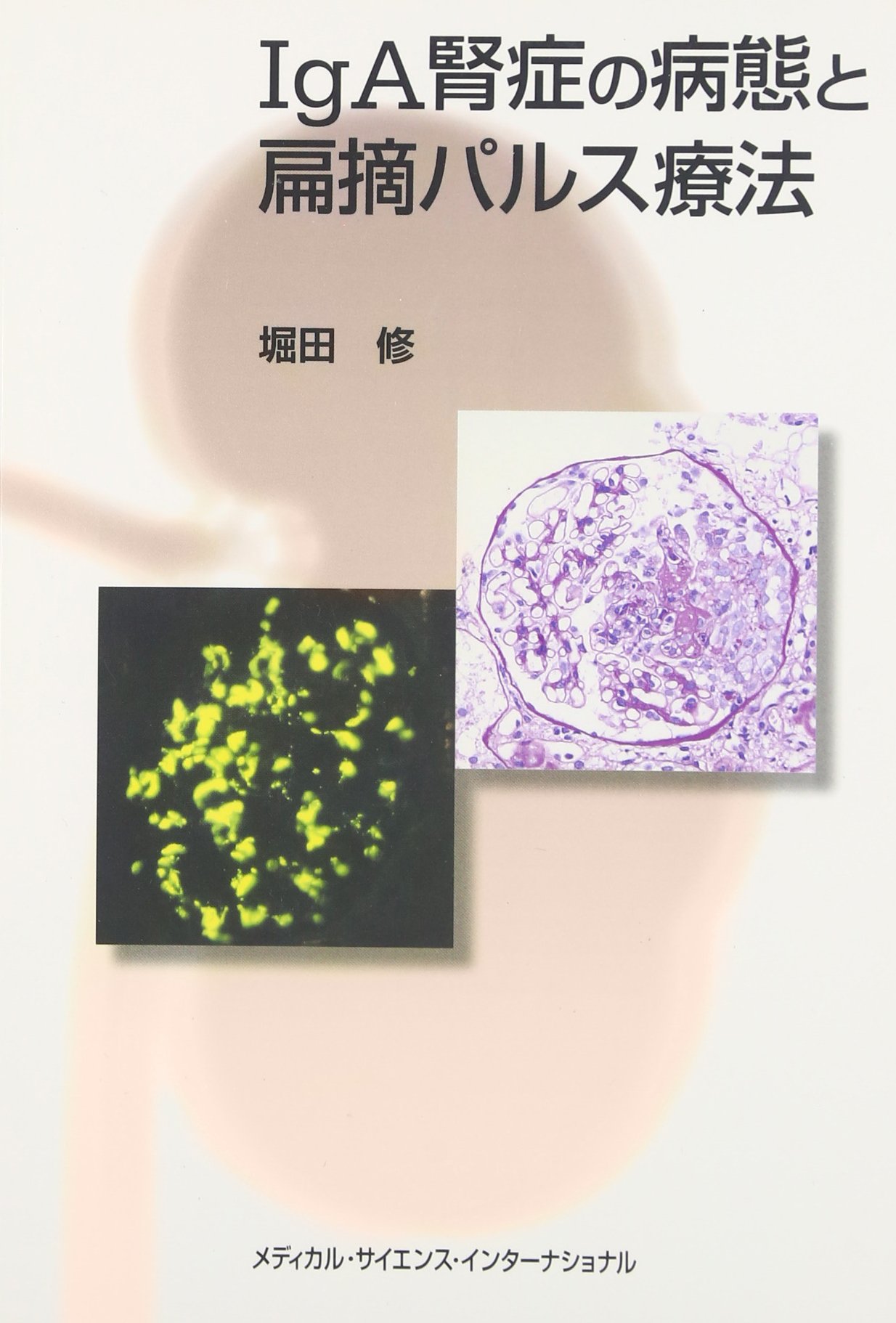 Iga腎症の病態と扁摘パルス療法 堀田 修 本 通販 Amazon