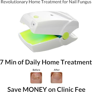 Haute Qualité à Ongles Moisissures Traitement Laser
