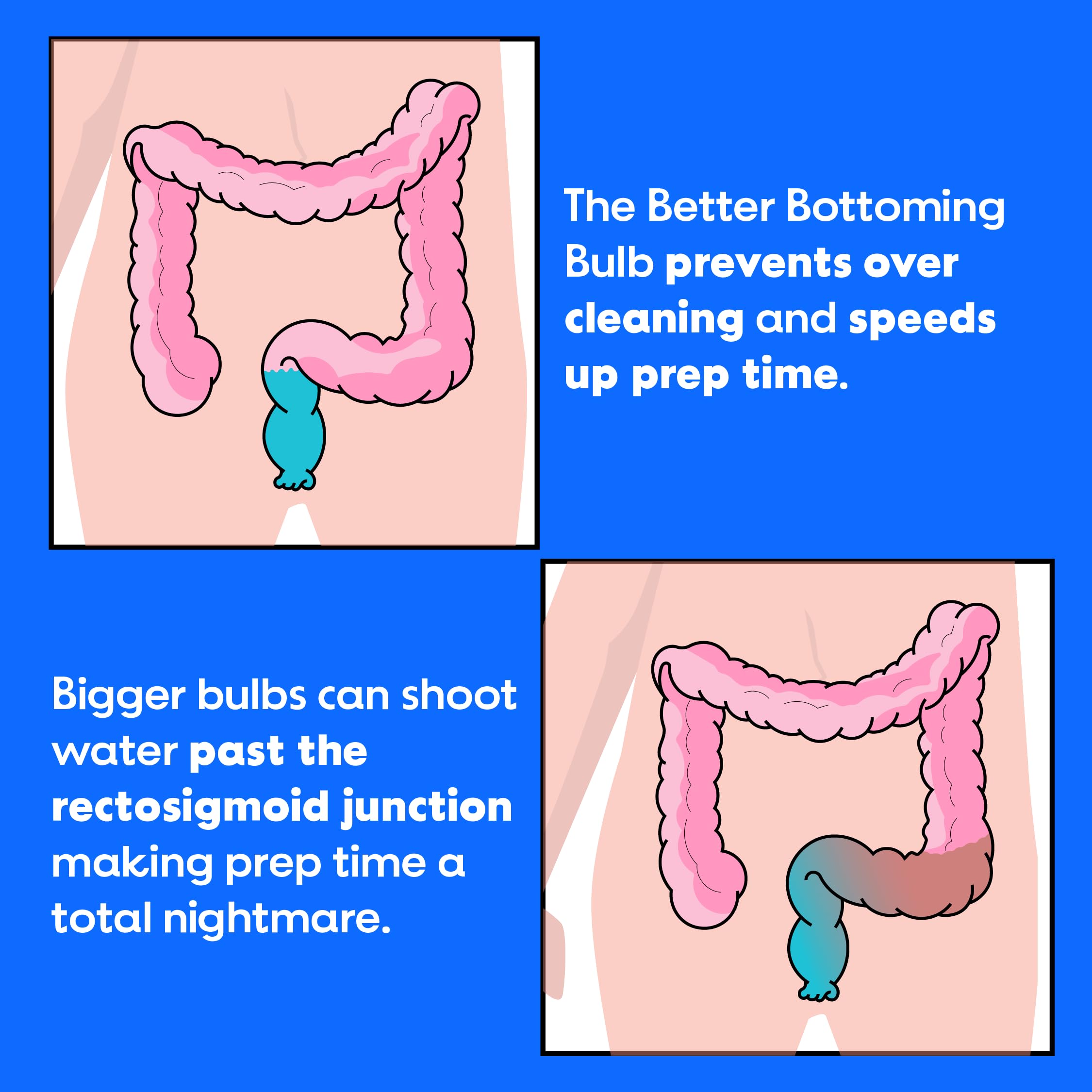 Bottom’s Digest Enema Bulb 3.0-oz Anal Douche with Easy-Clean 6-cm White Tip for Men & Women