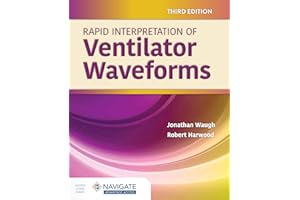 Rapid Interpretation of Ventilator Waveforms