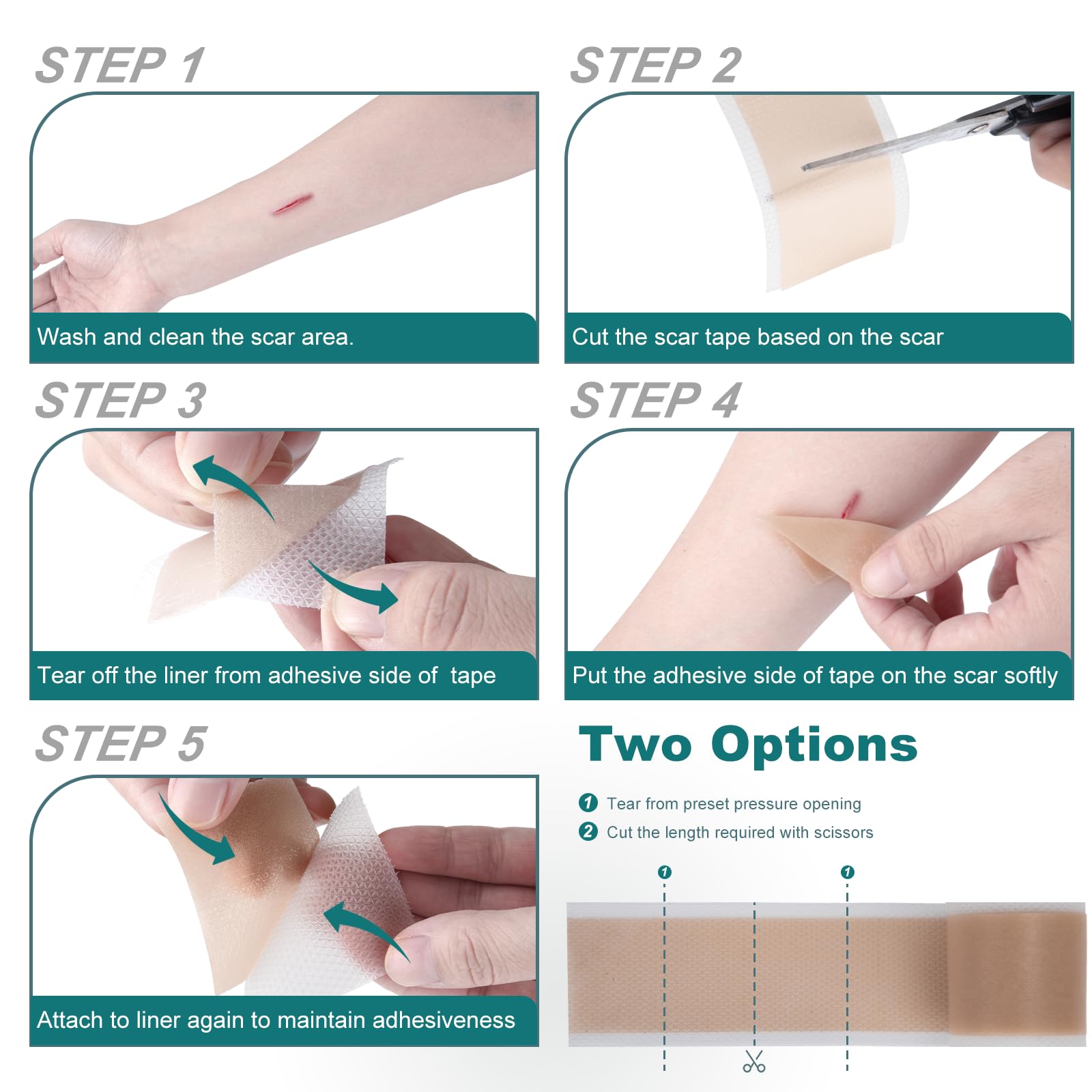 SLUKHIG Silicone Scar Sheets (1.6