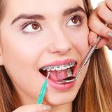 FUYOAL 80 Pcs Interdental Brushes Soft Dental Cleaning 4 Colors view 5