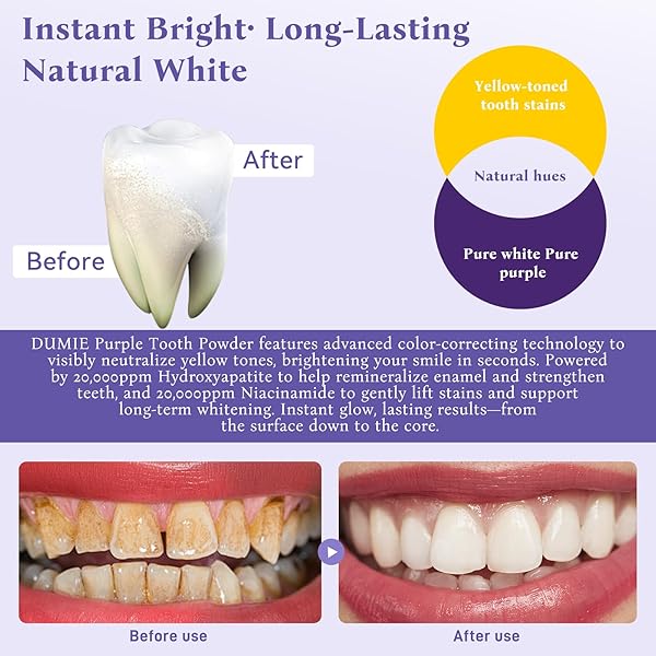 TEETH WHITENING POWDER, REMINERALIZING HYDROXYAPATITE TOOTH POWDER WITH NIACINAMIDE,R5X PURPLE COLOR CORRECTOR FOR INSTANT BRIGHTENING, ENAMEL REPAIR & LONG-LASTING NATURAL WHITE-30G