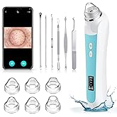 Blackhead Remover Vacuum, USB Interface Type Pore Vacuum, Black Head Extractions Tool with Camera for Men and Women Pore Cleaner, 3 Adjustment Modes & 6 Suction Heads(Blue)