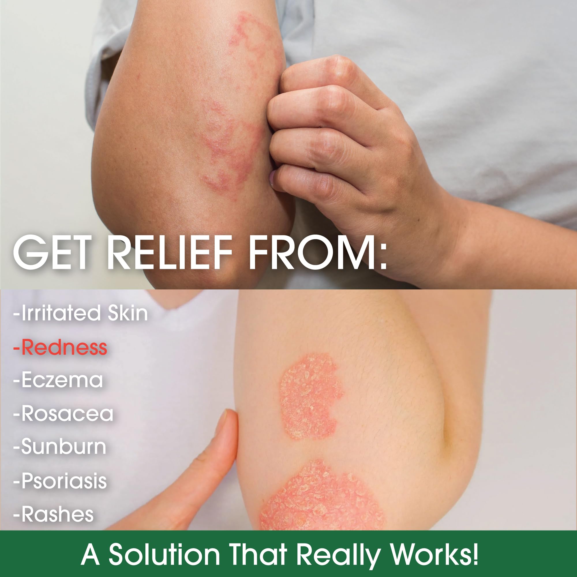 Green Leaf Naturals - Manuka Honey Face Cream - 16oz -Aloe Vera - Jojoba Oil Infused - Body Cream - Gluten Free Moisturizer for Kids & Adults - Nourishing Skin Care