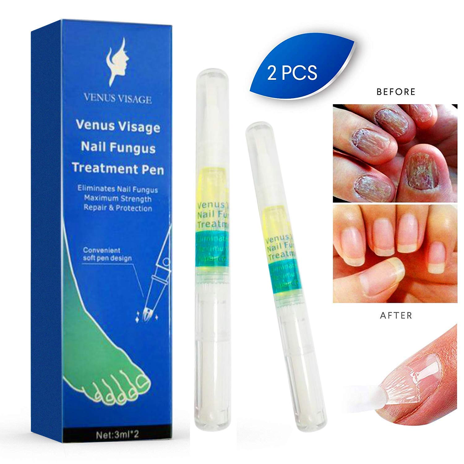 Snow & Ice Sports Nail Fungus Treatment,Fungus Stop,Nail Antifungal