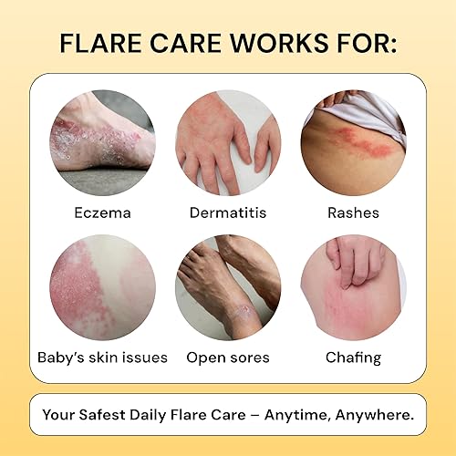 MyMagicHealer Universal Flare Care Essential Oil Free Relief
