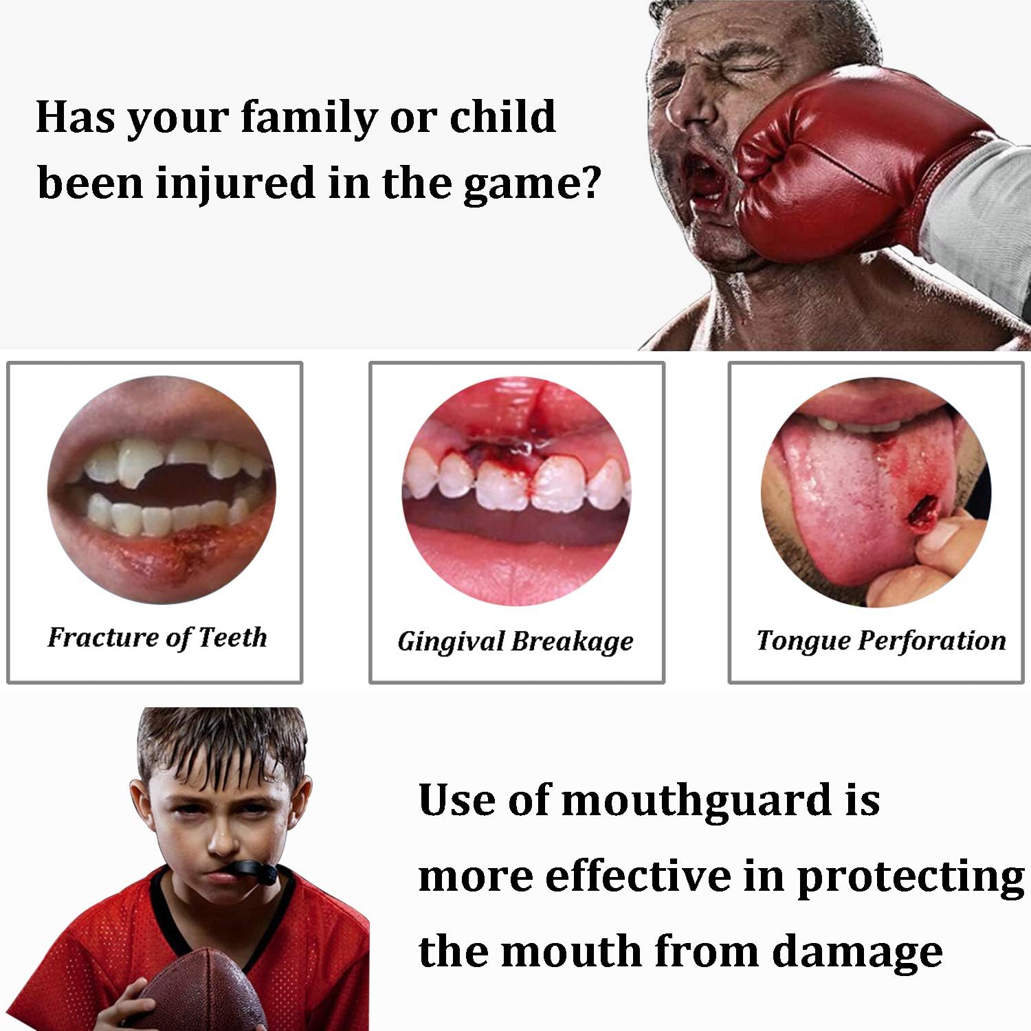 Mengdger Youth Mouth Guard Football Moldable MouthGuard Sports Kids Boys Mouthpiece Teeth Protective Braces EVA Double Colored for MMA Boxing Rugby Kickboxing Taekwondo Softball Lacrosse(3 Pack) : Sports & Outdoors