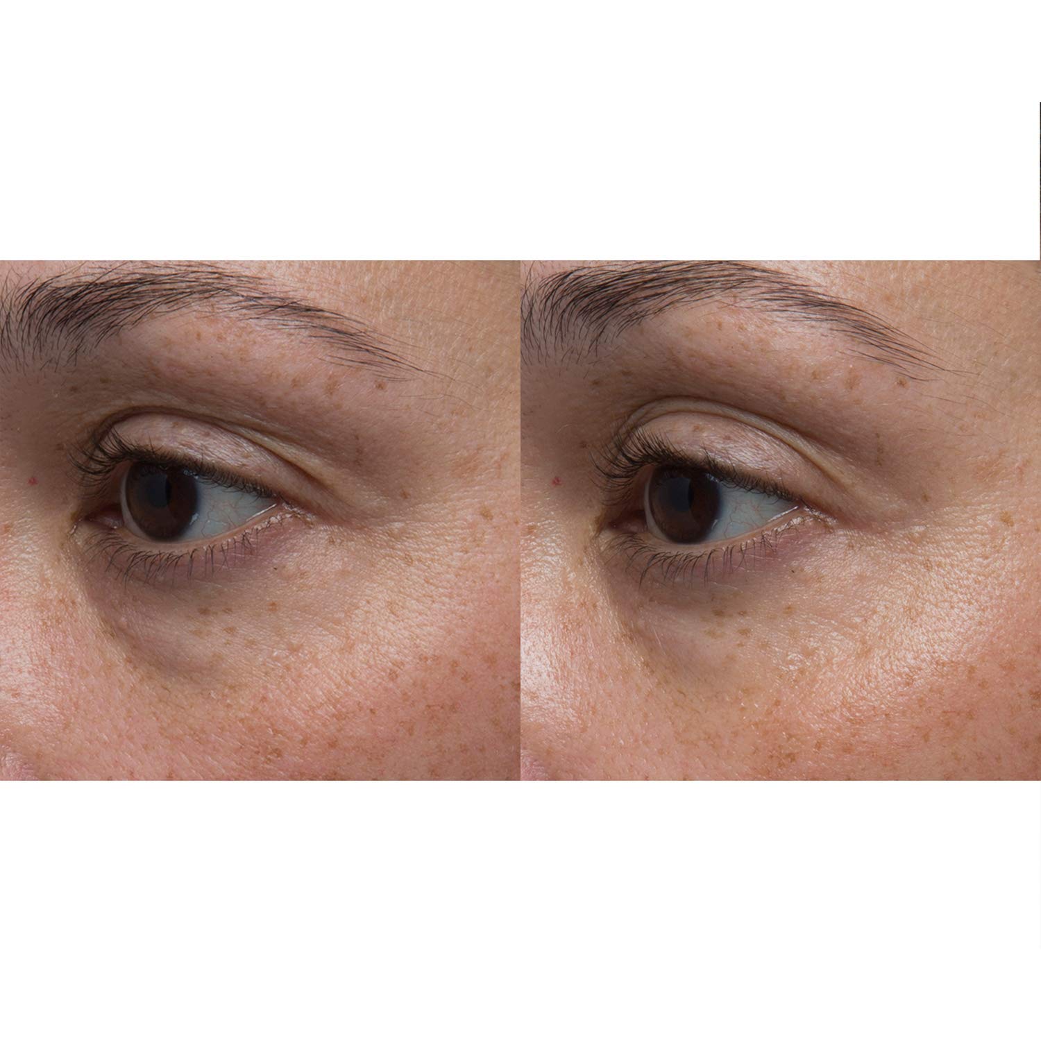 avocado retinol eye cream