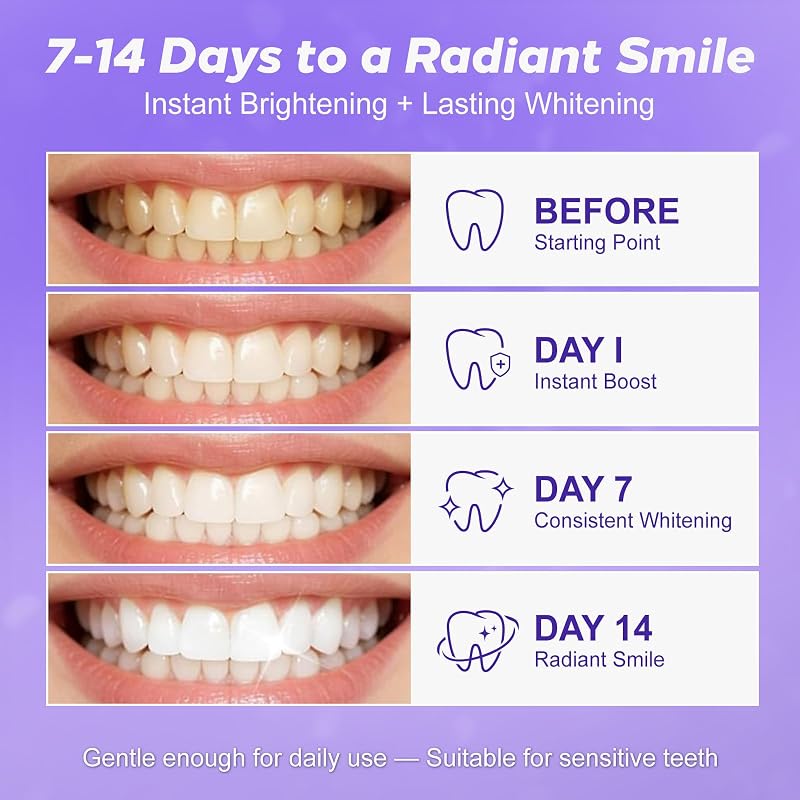 Tiras Blanqueadoras Dientes Moradas - 28 Tiras | Kit Blanqueador Dental Profesional con Tecnología Púrpura Correctora de Color | Blanqueamiento Dental Seguro para el Esmalte y Resultados Rápidos — foto 2 de 8