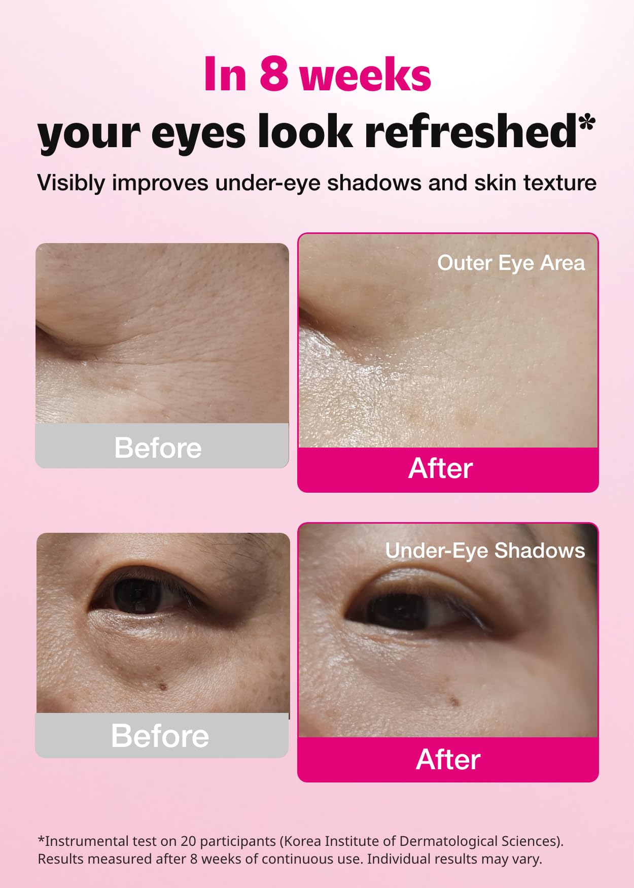 ISOI Blemish Care Under Eye Patch for Dark Circles, Puffiness and Wrinkles, Hydrating Gel Eye Masks with Hyaluronic Acid & Bulgarian Rose Oil, Korean Skin Care (90 pcs, 3.17 oz)