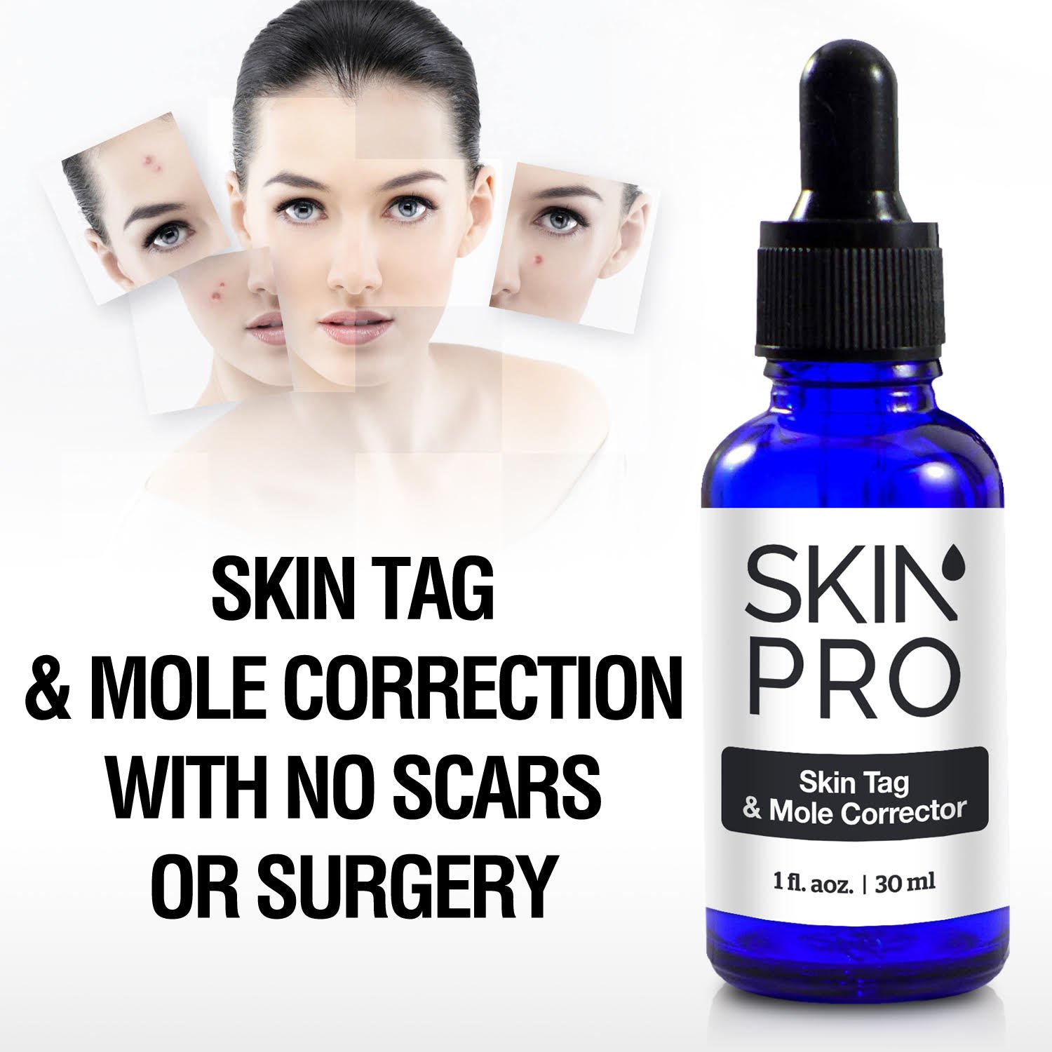 SkinPro Skin Tag Remover And Mole Corrector For Fast Removal Of Skin Moles, Skin Tags, Warts And Other Minor Growths, Medical Grade Formula with 17% Salicylic Acid (1 fl oz, 30 ml) : Beauty