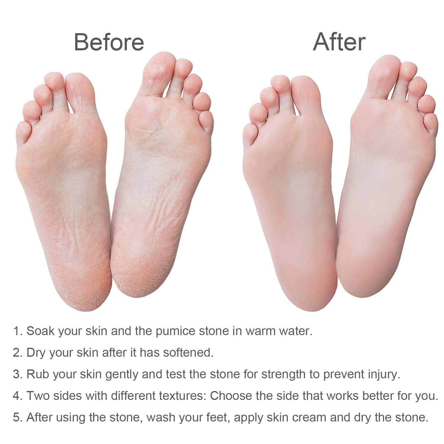4 PCS Gift Packaged Foot Pumice Stone Scrubber for Hard Skin, Heavy Callused Feet, Dead Skin, 2 in 1 Pumice Stone for Feet, Heels, Hands and Body: Beauty