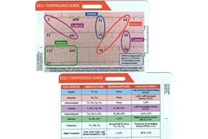 AUNVITO Funny ECG EKG Rhythm Pocket Card,Double Sided Badge Card EKG Telemetry Interpretation Badge Buddy Nursing Cheat Sheet with EKG Ruler Measurement (C)