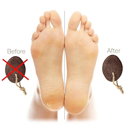 Pumice Stone Natural Earth Lava Brown Callus Corn Remover for Feet  Heels and Palm Pedicure Exfoliation T