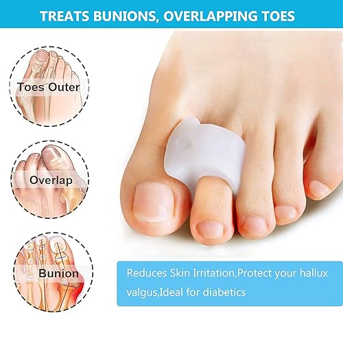 Bunion Corrector & Toe Straightener - Relief For Overlapping Toes With Natural Alignment