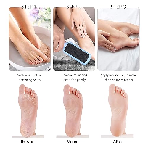 Get Rid Best Way To Remove Hard Skin From Feet Scholl Hard Skin