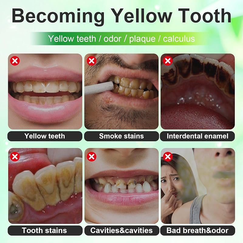 Professionelles Zahnaufhellungsset,10 Whitening-Serum,Zahnbleaching,Effektiv Flecken Entfernen für Weiße Zähne zu Hause,Teeth Aufhellung für ein strahlendes Lächeln,Für Damen und Herren