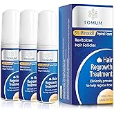 5% Minoxidil Foam for Men & Women: Topical Hair Regrowth, Fast-Absorbing Lightweight Minoxidil Treatment for Thinning Hair, Receding Hairline & Balding, Non-Greasy Unscented Hair Growth Foam