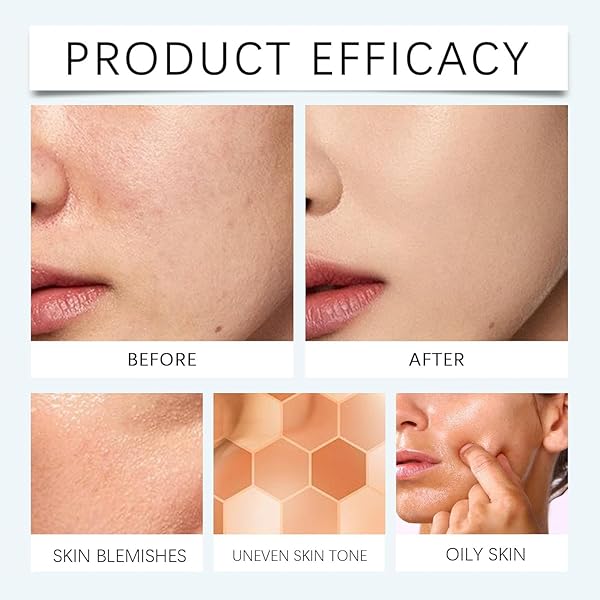 LIOZXIUT SUPREME CREAM BODY PERFECTOR, SUPREME CREAM ALL-OVER COMPLEXION PERFECTOR – LASTING CC CREAM FOUNDATION，WATERPROOF & TRANSFER-RESISTANT SKIN TINT. (1PCS)