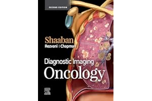 Diagnostic Imaging: Oncology E-Book