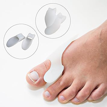 correcting soft corns