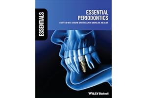 Essential Periodontics