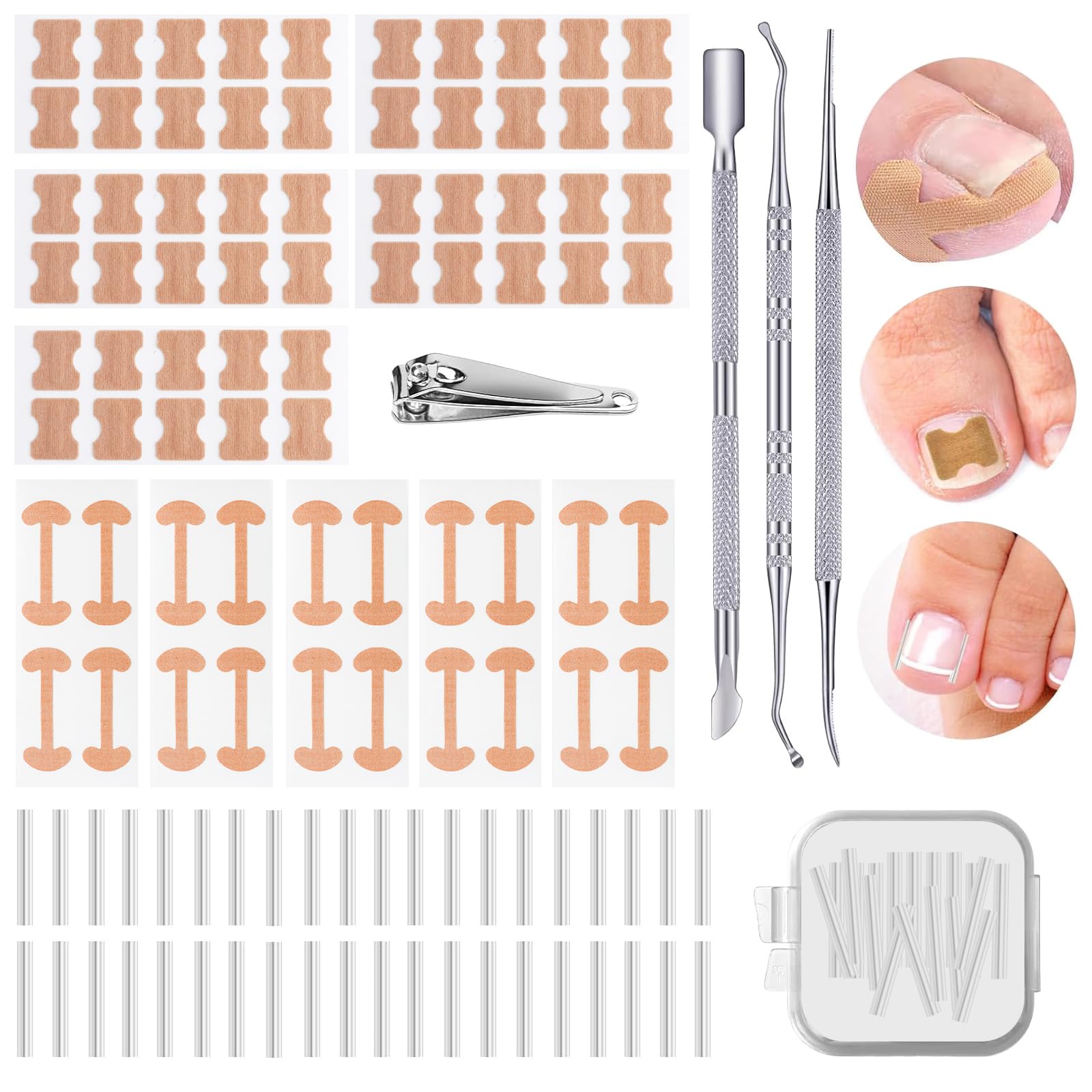 114 Pcs Ingrown Toenail Treatment Corrector, Ingrown Toenail Tool with Nail Clippers Ingrown Toenail File and Lifter, Ingrowing Toenail Treatment Kit, Pedicure Tools for Caring for Toes