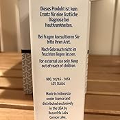 2 Pack - Premium Sulfur Soap, Schwefel Seife, Cleansing ...
