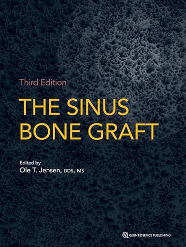 Download The Sinus Bone Graft PDF