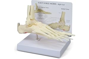 GPI Anatomicals - Foot and Ankle Model, Replica of Foot and Ankle with Plantar Fasciitis for Human Anatomy and Physiology Education, Anatomy Model for Doctor's Office, Medical Learning Resources