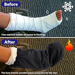 Shupakul 2 Pcs Leg Cast Covers- 21 x 12.5 Inch