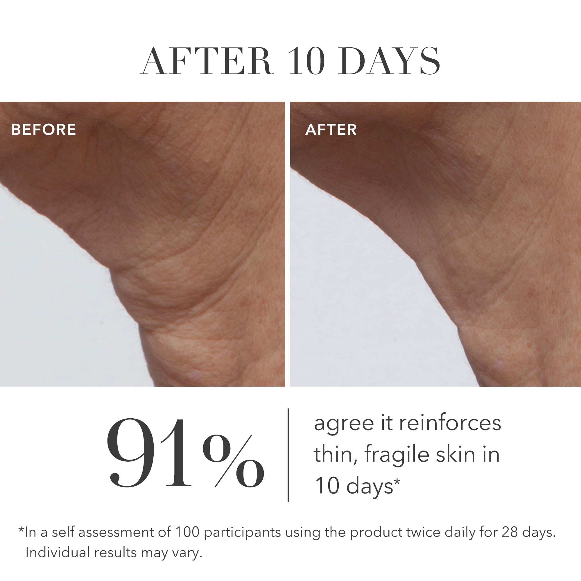Algenist GENIUS Ultimate Anti-Aging Cream - Vegan Firming & Smoothing Moisturizer with Alguronic Acid & Microalgae Oil - Non-Comedogenic & Hypoallergenic Skincare
