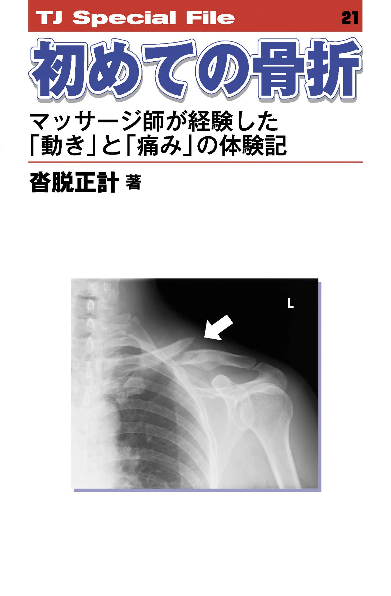 初めての骨折 マッサージ師が経験した 動き と 痛み の体験記 Tj Special File 21 沓脱正計 本 通販 Amazon