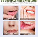 HIVETZ Mouth Ulcer Treatment Spray Herbal Breath Freshener Adults view 3