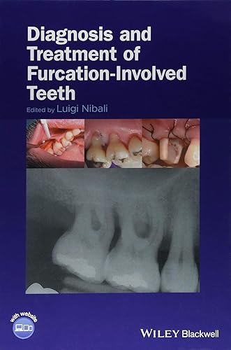Download Diagnosis and Treatment of Furcation-involved Teeth PDF