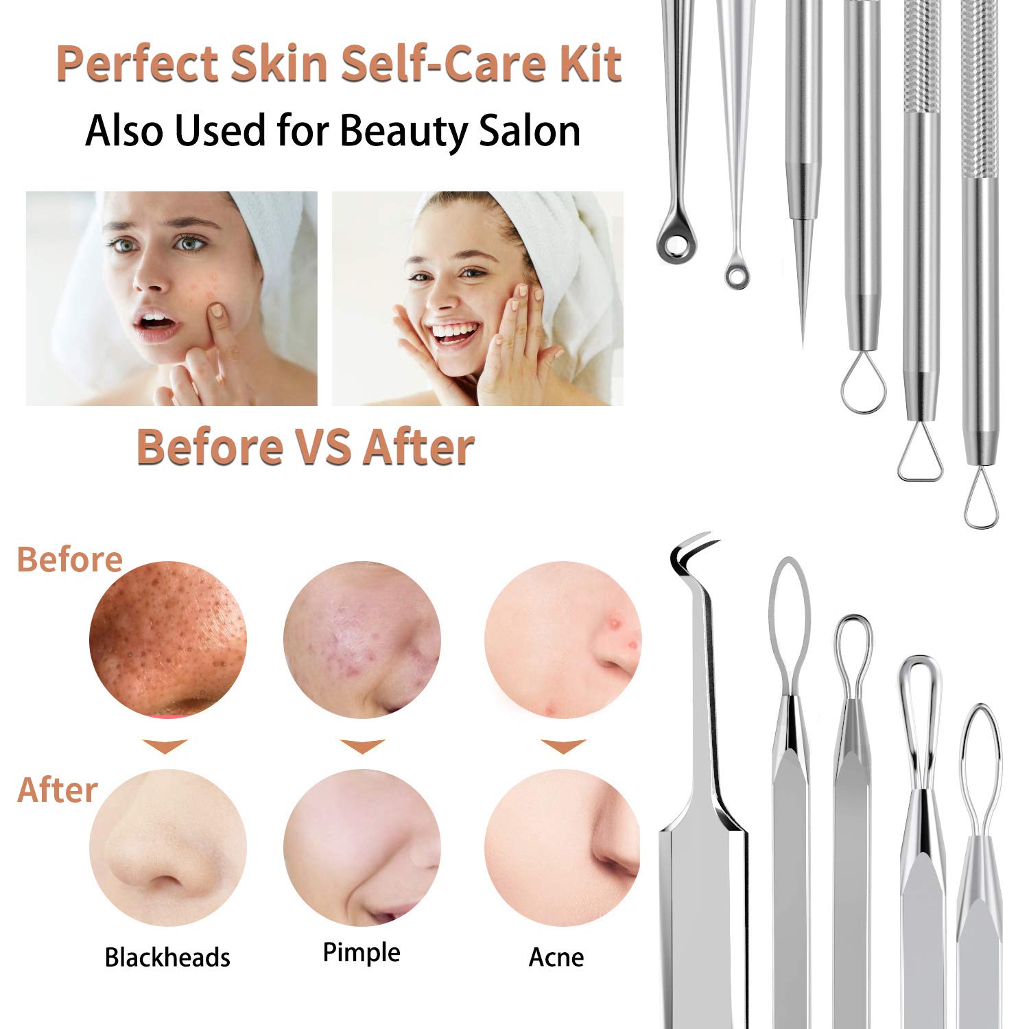 Anjou Blackhead Remover Comedone Extractor, Curved Blackhead Tweezers Kit, 11-Heads Professional Stainless Pimple Acne Blemish Removal Tools Set, Silver: Beauty