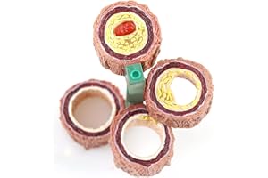 4-Piece Artery Model, Atherosclerosis Model with Plaque Build Up,Human Artery Blood Vessel Anatomy Model,Anatomy Model for Do