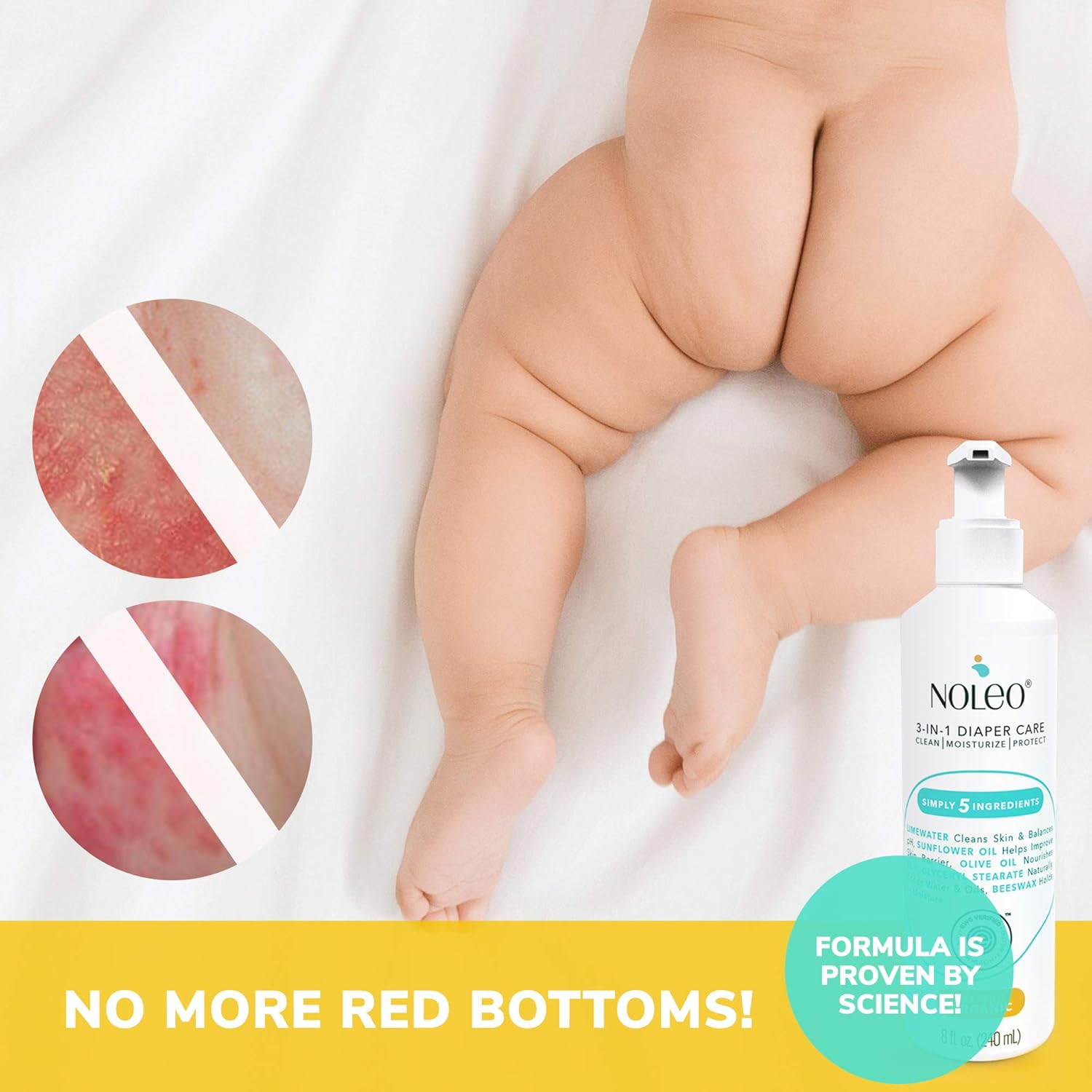 3 in 1 Certified Organic and EWG Verified Diaper Care, Baby Care Skin Cleanser, Rash Cream, Moisturizing Lotion - NOLEO (Baby Box): Health & Personal Care