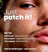 roselynboutique Pimple Patches Hydrocolloid 300 Dots Clear Sizes 8-14mm view 5