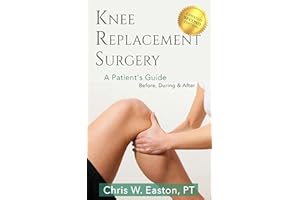 Knee Replacement Surgery, A Patient's Guide: Before, During & After