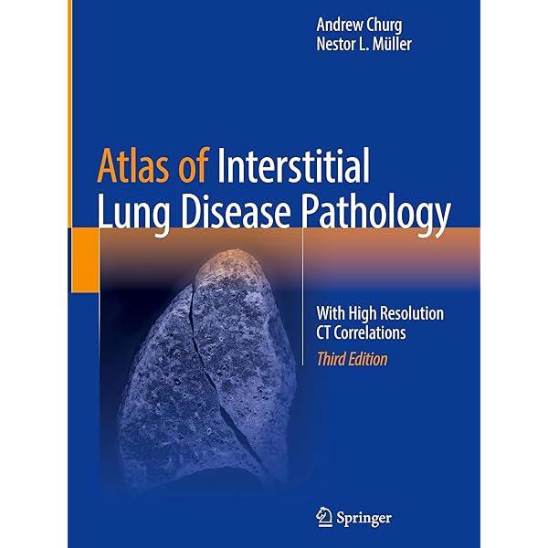 High-Resolution CT of the Lung: 9781451176018: Medicine